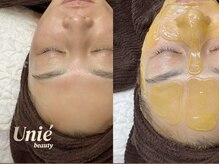 ユニエビューティー(Unie Beauty)