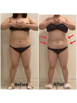 スペチアーレ 夙川/柔らかい脂肪にオススメ