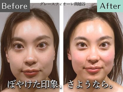 グレースフィオーレ 南越谷店(gracefiore)の写真