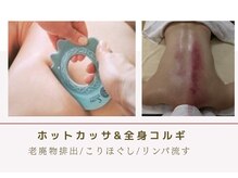 ルナビューティー 赤坂(LUNA beauty)/ カッサとコルギのWアタック