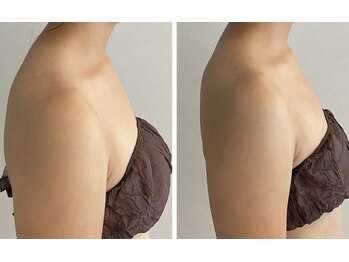 ココノア(COCONOA)の写真/ボディラインを整えたい方へ！肩甲骨の動きがよくなるケアで理想の自分を目指す！