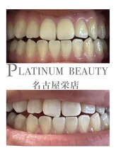 プラチナムビューティー 名古屋栄本店(PLATINUM BEAUTY)/お客様Before After