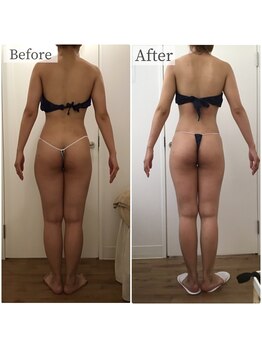 ボーレーヴ(beau reve)/ブライダル/インディバ/痩身