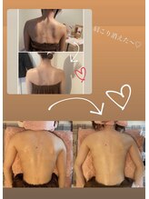 ルト(RUTO)/ブライダルエステとして