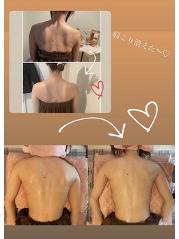 ルト(RUTO)/ブライダルエステとして