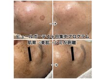 ポノ(pono)の雰囲気（シミシワお顔のたるみ一挙改善　肌育コース4ヶ月集中プログラム）