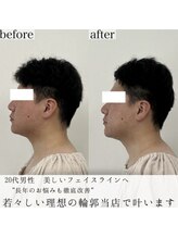 ヴェルシック(Belchic)/男性の凛々しい横顔叶えます