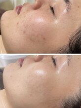 フィール(feel)/Before/After