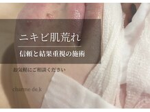シャルム ド ケー(charme de k)の雰囲気(ニキビ肌荒れでお悩みの方、お任せください!)