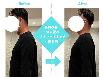 ビーキューオーエル(美QOL)/症例写真