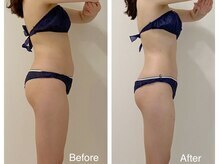 美庵 池袋店/池袋痩身アロマリンパマッサージ