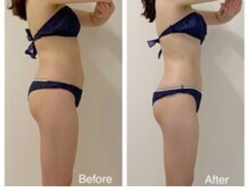 美庵 池袋店/池袋痩身アロマリンパマッサージ