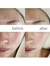 フェリノ(FERINO)/ホームケアをサロンで格上げ