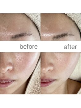 フェリノ(FERINO)/ホームケアをサロンで格上げ