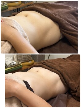 ワッカ(wacca)/YOLO式腸もみ