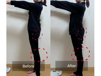 ヨサパーク ウイ(YOSA PARK Ui)/20代女性 before/after