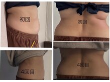 メディカルエステ ユウ(Yuu)の雰囲気（食事制限なし。運動が苦手。でも綺麗になりたい方でも痩せます！）