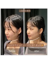 サリエ(S'allier)/お客様のビフォーアフター