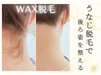 レヴィート(Revept)の写真