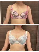 エパノーラ 名古屋(Epanoura)/30代後半女性　1ヶ月後の変化