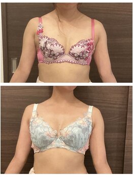 エパノーラ 名古屋(Epanoura)/30代後半女性　1ヶ月後の変化