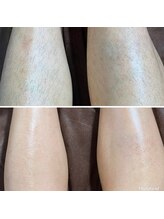 マイレ 銀座(MAILE)/膝下