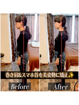 てんてんてんまてん/姿勢矯正/骨盤矯正/整体/巻き肩