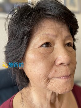 リアンシャンテ(Re enchanter)/☆初回お手入れ前(右顔)