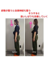 ニコ(Nico)/before・after　小顔矯正