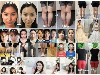 ビモテ 博多(bimote.)の写真