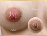 モニター限定！【黒ずみ/メラニンケア"ルメラ】乳輪89,000→72,000