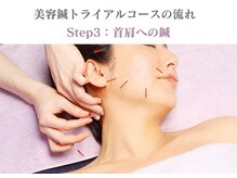 シー バイ カリスタ 表参道店(C by CALISTA)/美容鍼トライアルコースの流れ