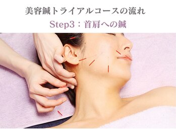 シー バイ カリスタ 表参道店(C by CALISTA)/美容鍼トライアルコースの流れ