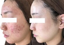 エピア 半田店(Epia)