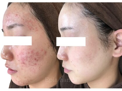 エピア 半田店(Epia)の写真