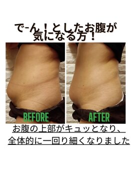 タマエステティックサロン 河辺店/痩身エステ