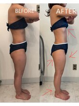 シャルール(chaleur)/痩身80分