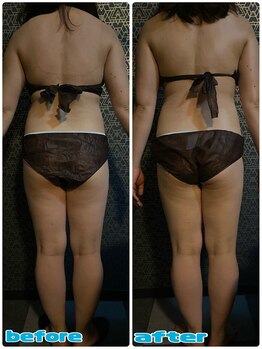 ラクラク(rakuraku)/痩身【全身】90分(1回目)