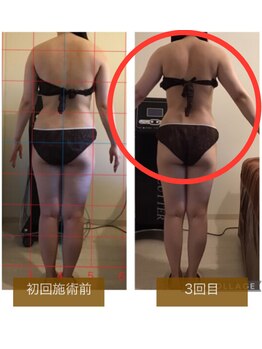 サロンドボーテ ヴィクトワール マルヤマ(Salon de beaute VICTOIRE MARUYAMA)/フォースカッター【w1ペース】