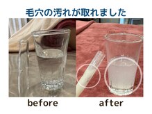 トータルセラピー リッチ(Rich)/毛穴の汚れが取れます