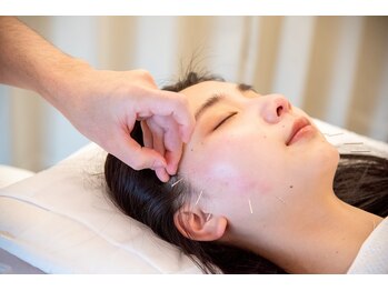 しらゆき堂鍼治療院/リフトアップ特化型美容鍼