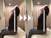 ミライズ整体院 三宮本院/事例【30代女性・首コリ】