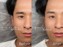 トレミニョン(tres mignon)/間引きで出来るタレ眉改善！