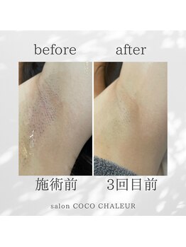 ココ シャルール(salon COCO CHALEUR)/Before　After