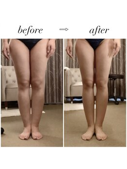 スラン(Slan)/美脚筋膜リリース