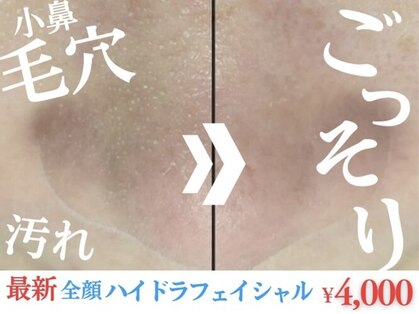 チル(chill)の写真