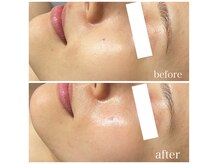 ナーズ(NAZ)の雰囲気（新メニュー『乳酸ピール』で肌育。整えるピーリング）