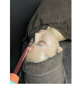 プレイス 堂山本店(PLACE)/ハーブピーリング