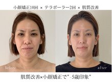 サロンメロウ 大牟田店(salon mellow)の雰囲気（小顔矯正×肌質改善で鏡を見るたびに憂鬱な毎日から卒業）