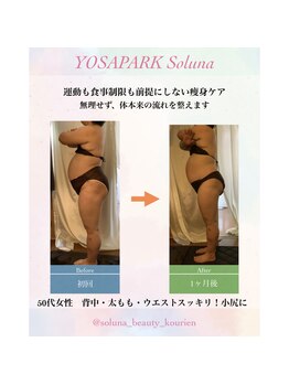 ヨサパーク ソルナ(YOSA PARK Soluna)/【ウエスト集中】驚きの変化☆